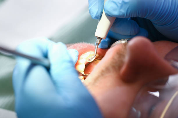 Best Cracked Tooth Emergency Dentist  in Ellaville, GA