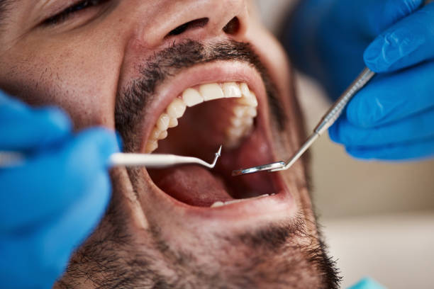 Best Broken Tooth Emergency  in Ellaville, GA